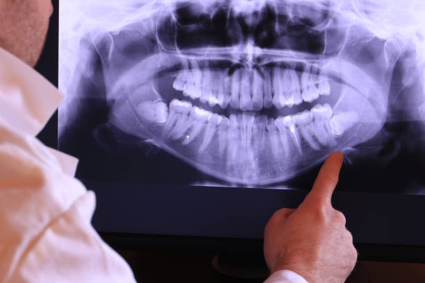 Best Emergency Dental Extractions in Friendly, MD