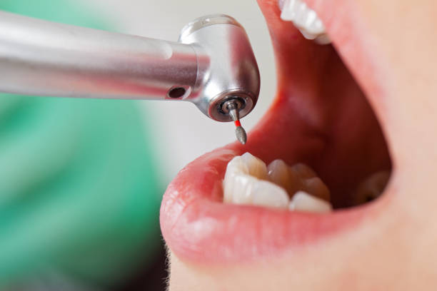 Best Pediatric Emergency Dentist in Friendly, MD
